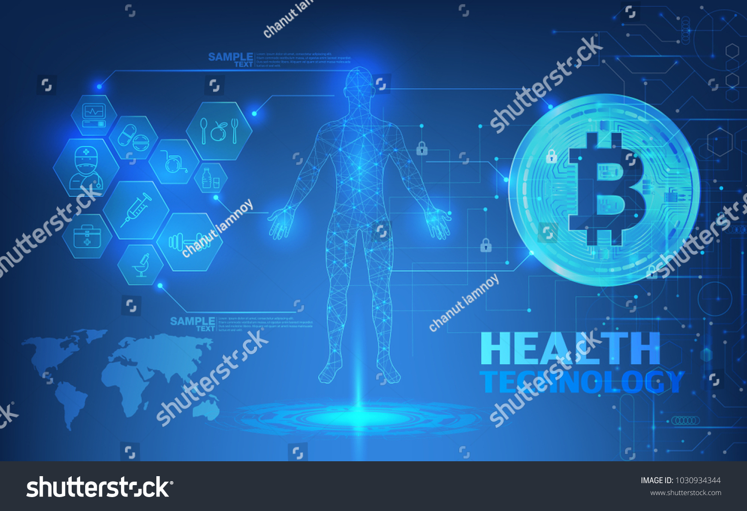 IP