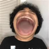 Lo