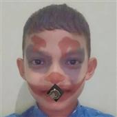 ch