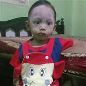Ng